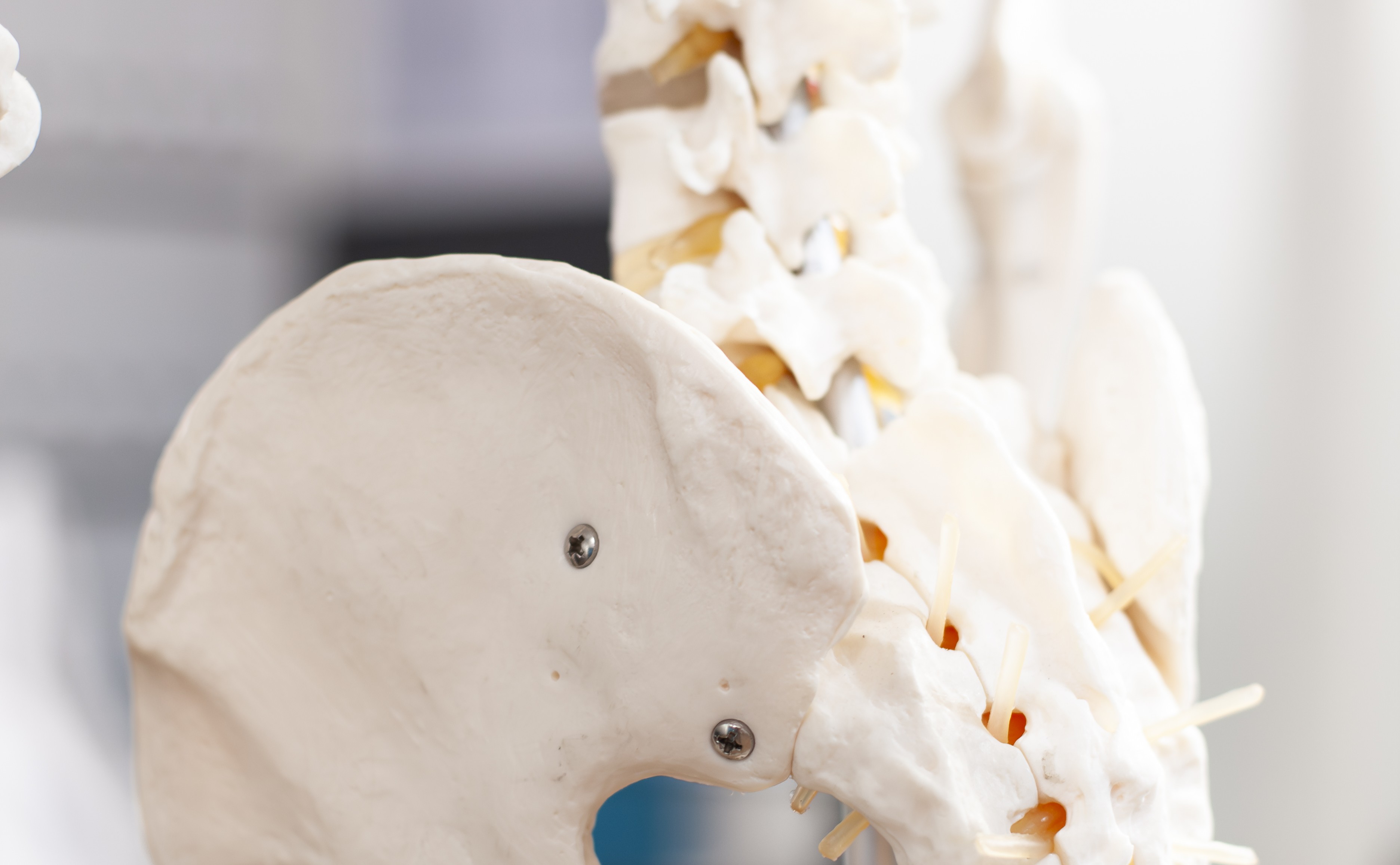 Wirbelsäulenimplantate und moderne Wirbelsäulenchirurgie